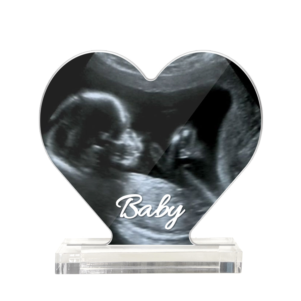 Custom Ultrasound Photo Heart Shaped Acrylic Plaque Gift